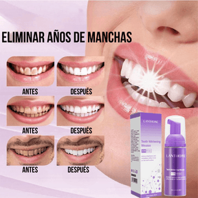 BLANQUEAMIENTO DENTAL LANTHOME FRESH WHITE [RESULTADO PROBADO]